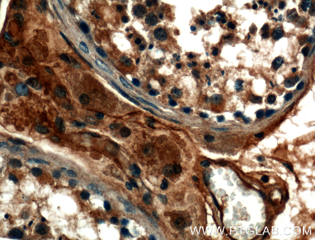 IHC staining of human testis using 25505-1-AP