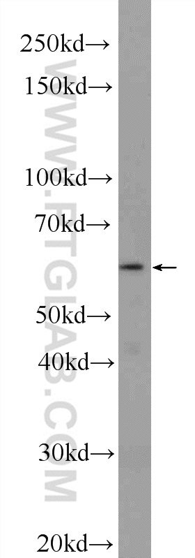 WB analysis of HepG2 using 25505-1-AP