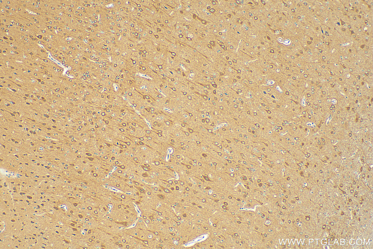 IHC staining of rat brain using 20995-1-AP