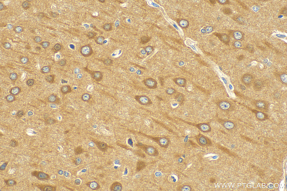 IHC staining of rat brain using 20995-1-AP