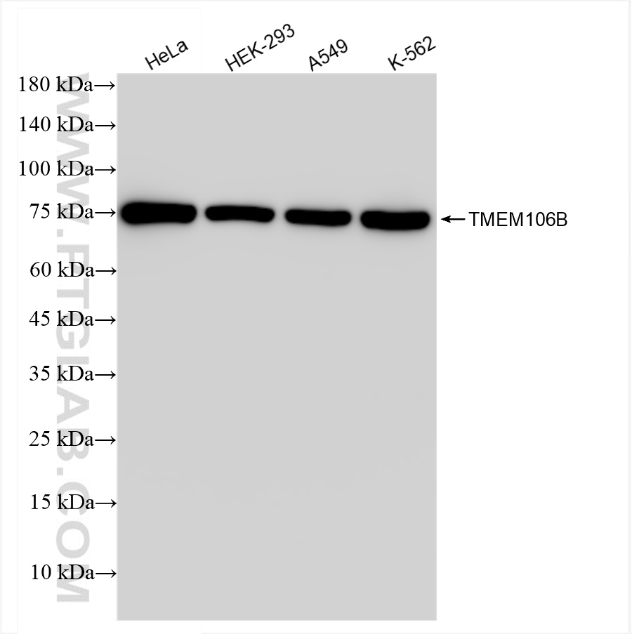 TMEM106B