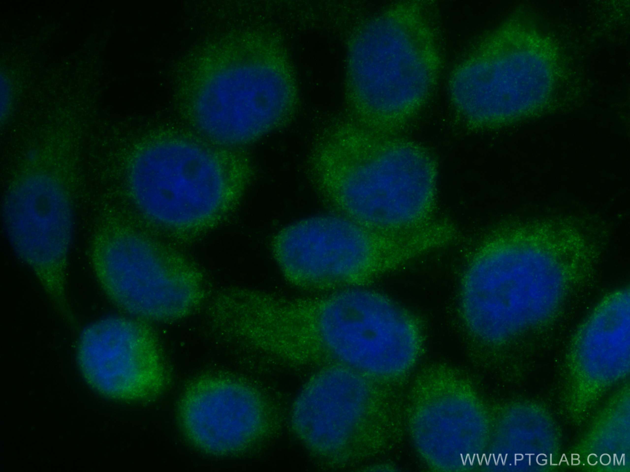 IF Staining of A431 using 24645-1-AP