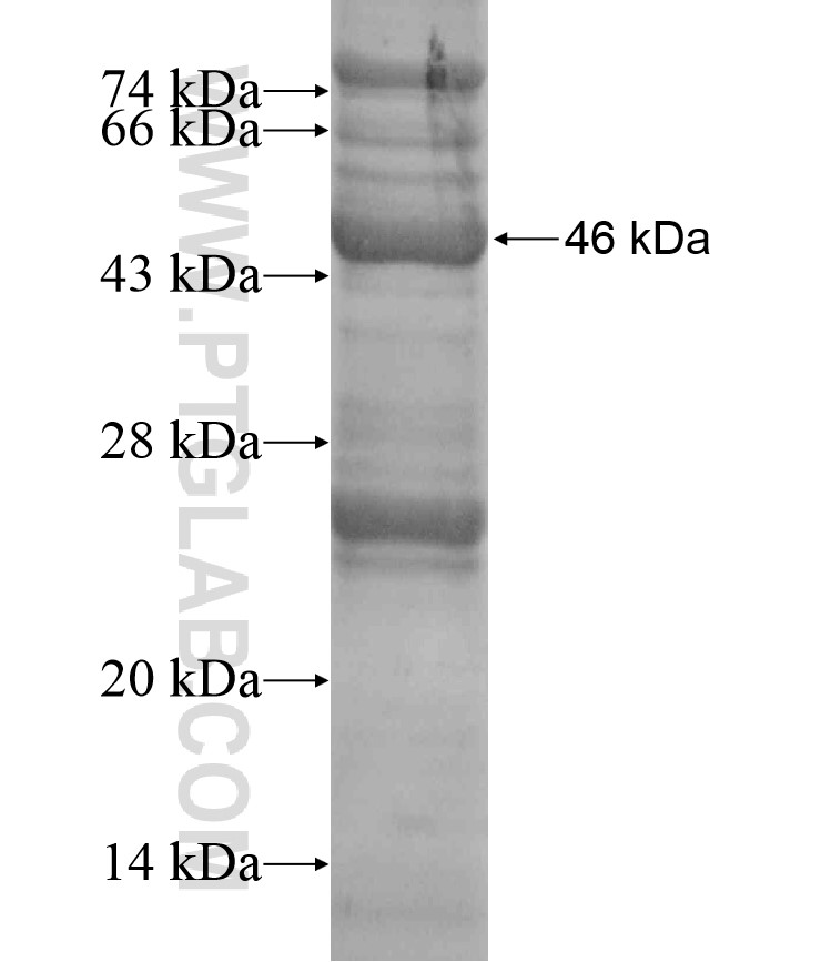 TMEM111 fusion protein Ag18236 SDS-PAGE