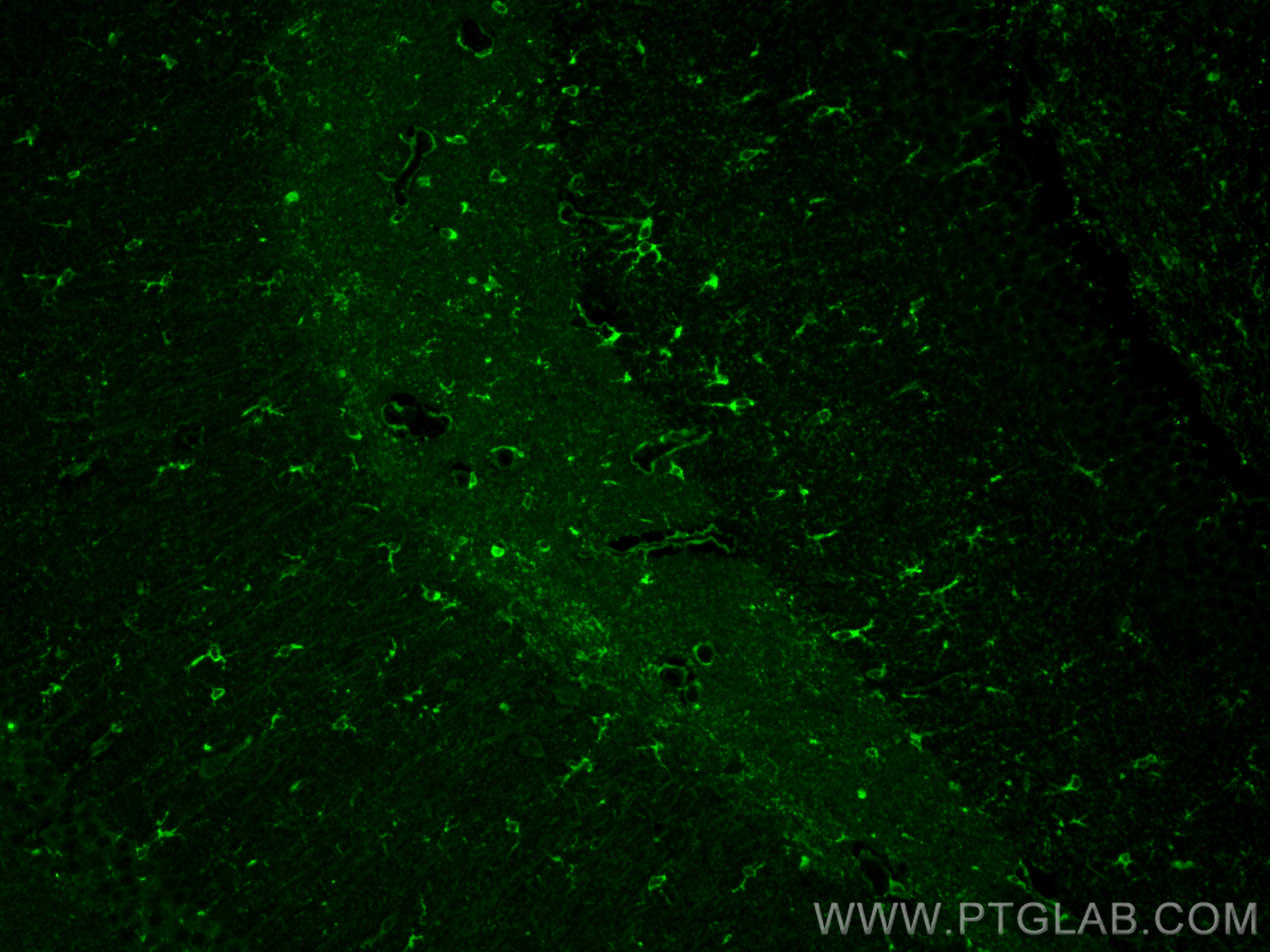 IF Staining of mouse brain using 27585-1-AP