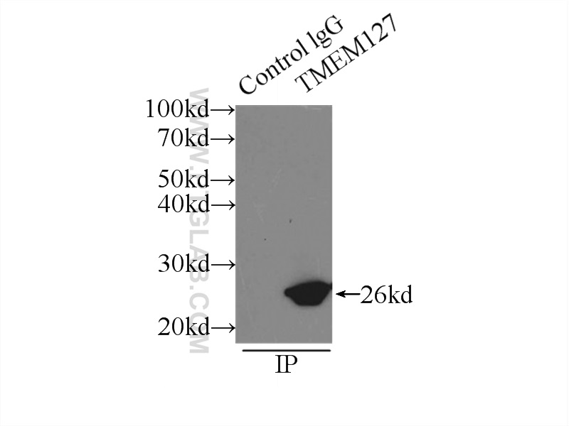 IP experiment of HeLa using 23142-1-AP