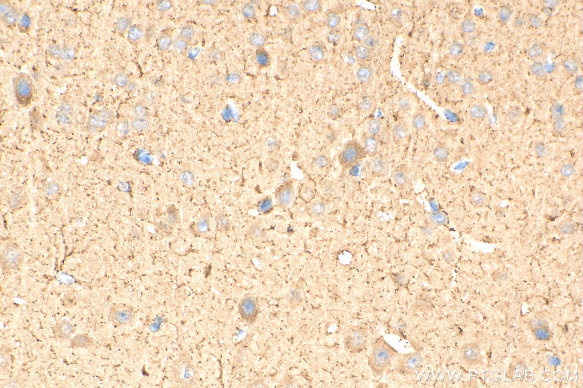 IHC staining of mouse brain using 25301-1-AP