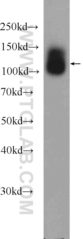 WB analysis of fetal human brain using 25301-1-AP