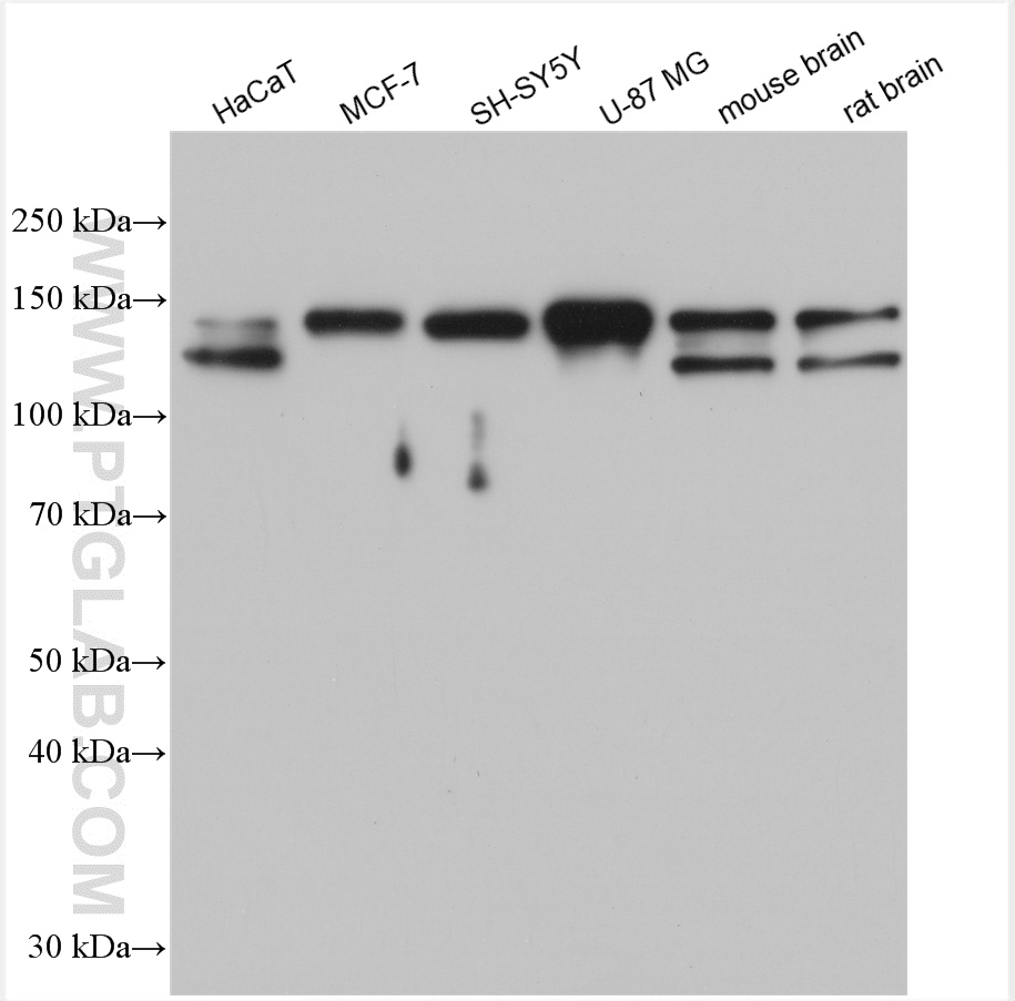 WB analysis using 25301-1-AP