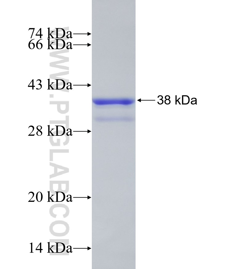 TMEM132A fusion protein Ag18149 SDS-PAGE