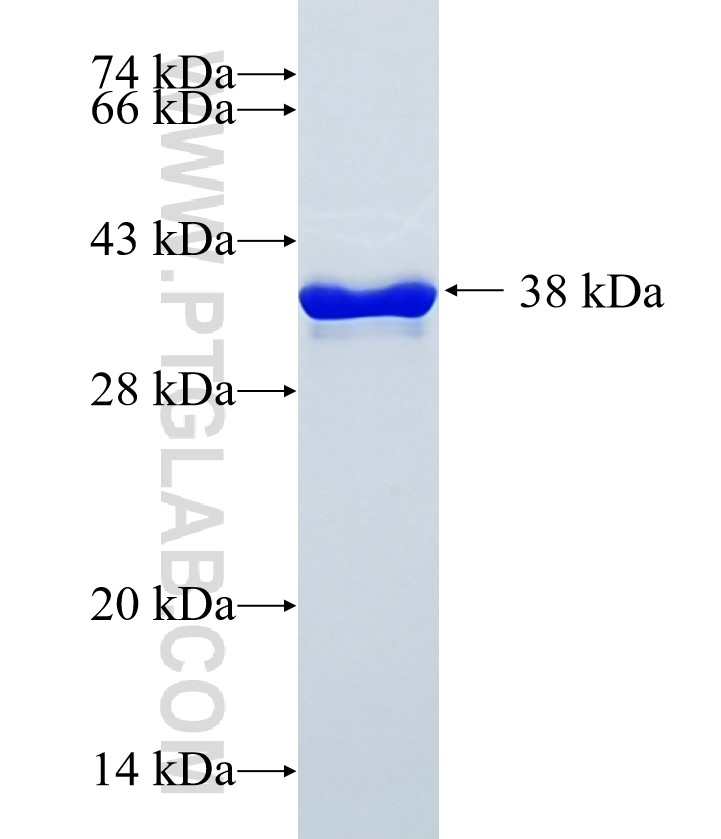 TMEM132B fusion protein Ag21548 SDS-PAGE