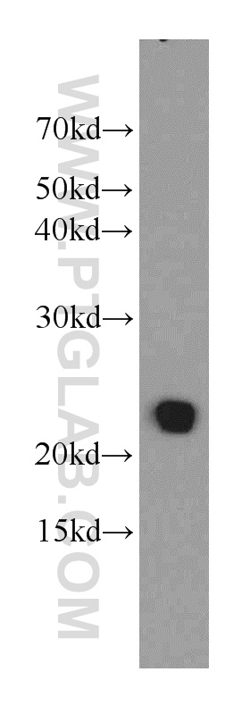 WB analysis of mouse lung using 21912-1-AP