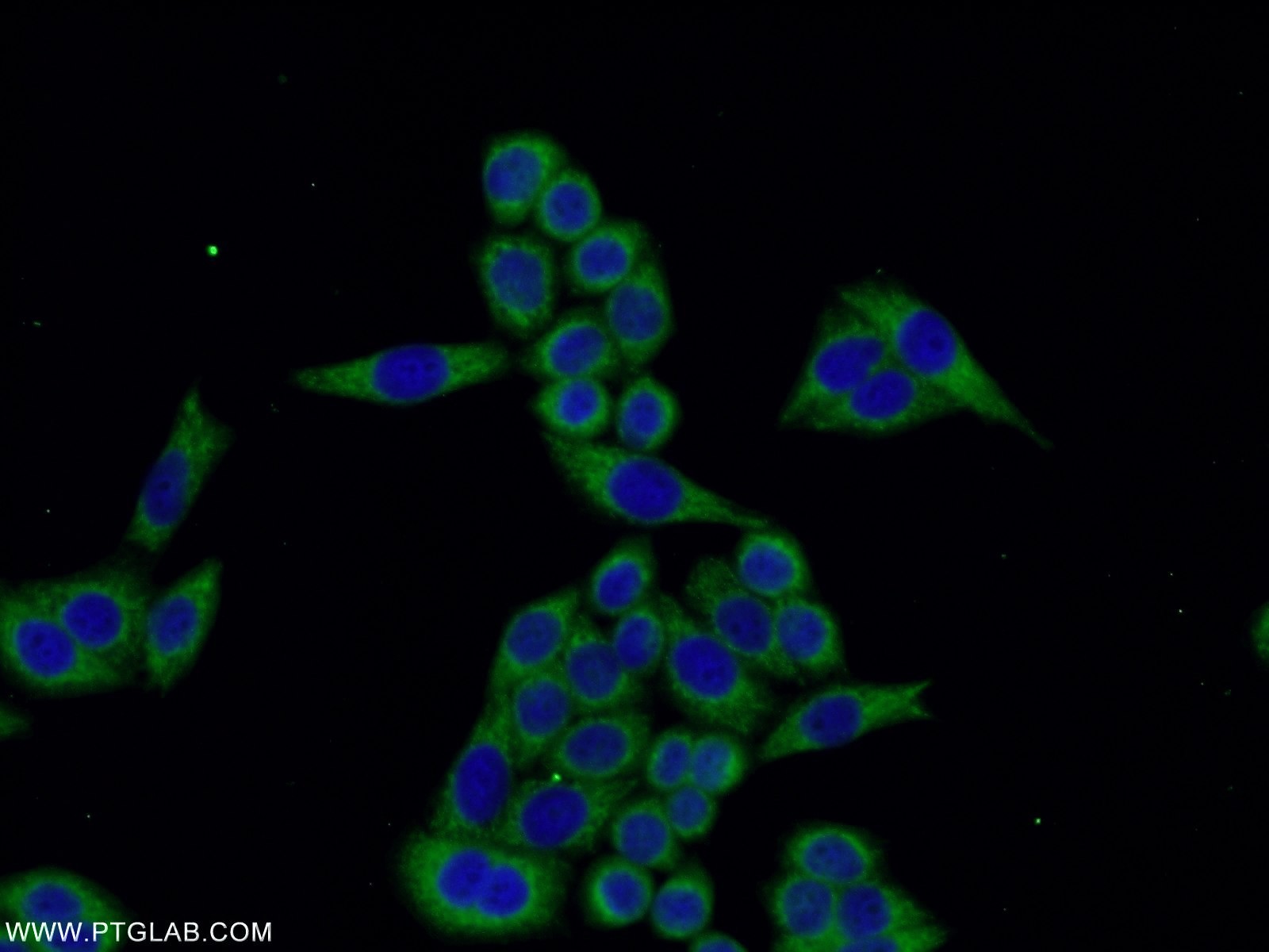 IF Staining of HeLa using 16092-1-AP