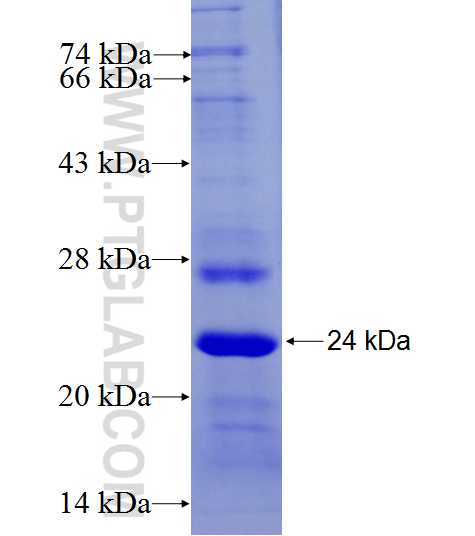 TMEM146 fusion protein Ag27359 SDS-PAGE