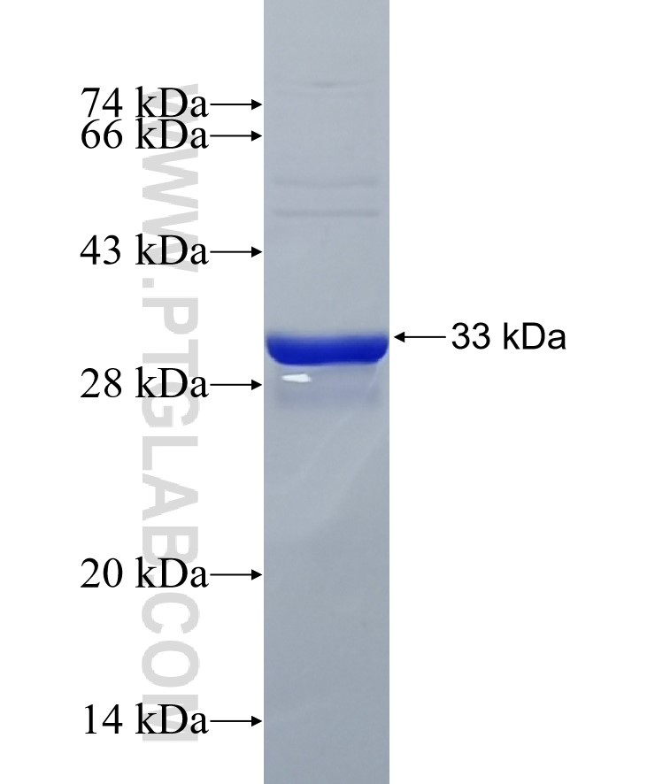 TMEM160 fusion protein Ag24915 SDS-PAGE