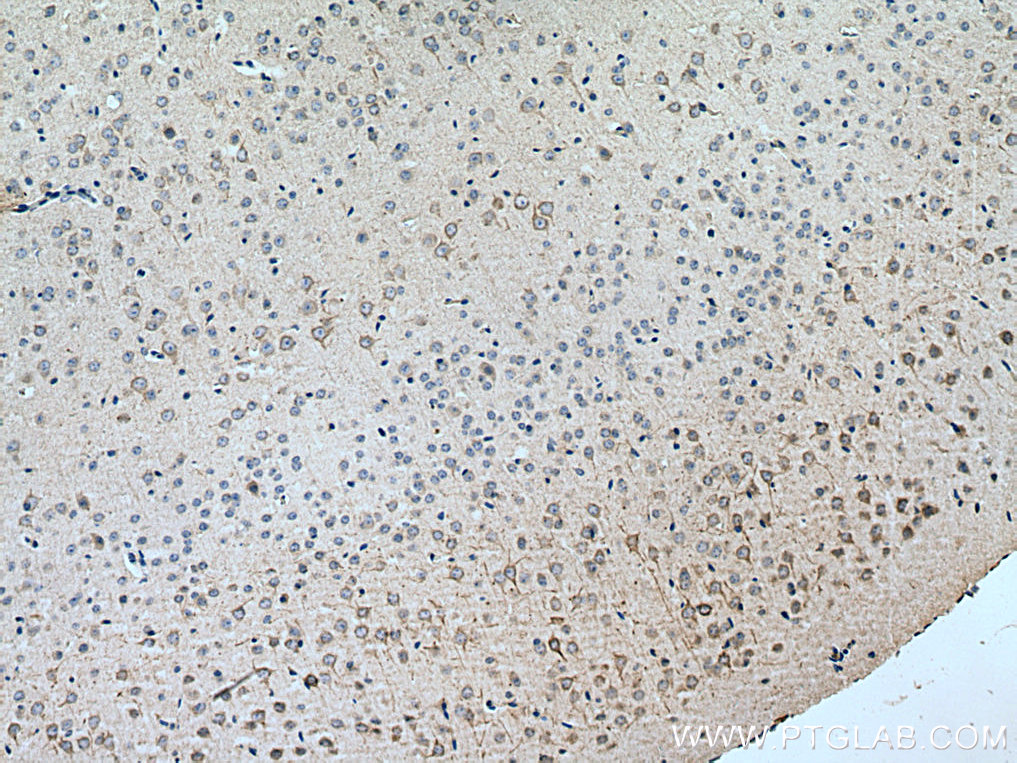 IHC staining of mouse brain using 24898-1-AP