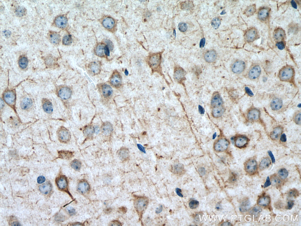 IHC staining of mouse brain using 24898-1-AP