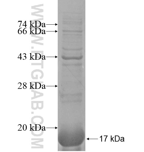 TMEM165 fusion protein Ag14872 SDS-PAGE