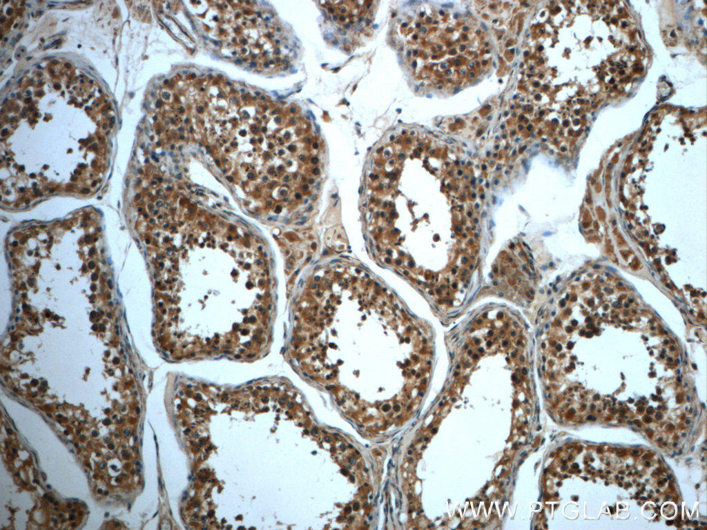 IHC staining of human testis using 22527-1-AP