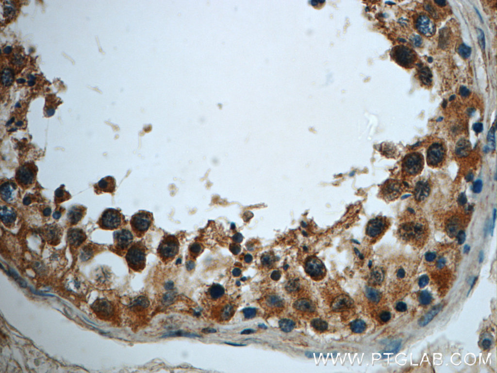 IHC staining of human testis using 22527-1-AP