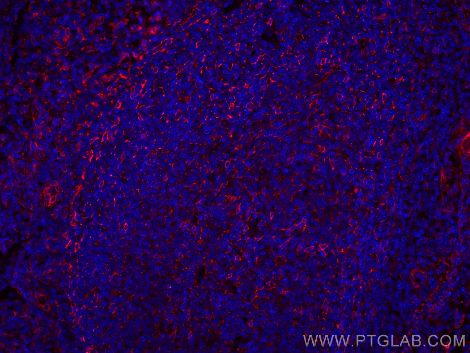 IF Staining of human tonsillitis using CL594-80165