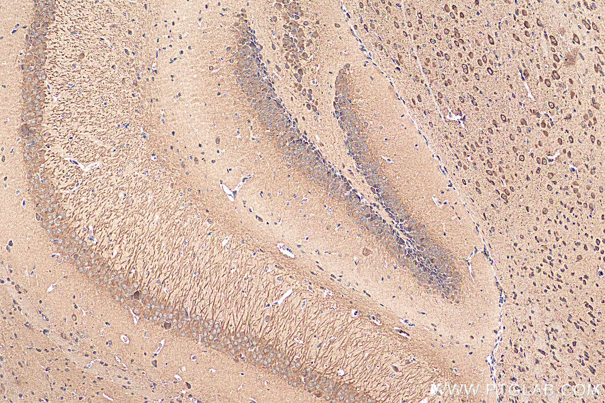 IHC staining of mouse brain using 19925-1-AP (same clone as 19925-1-PBS)