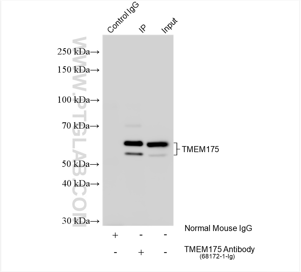 IP experiment of mouse brain using 68172-1-Ig