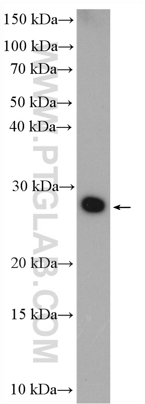 WB analysis of fetal human brain using 20378-1-AP