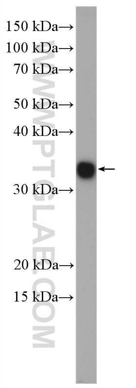 WB analysis of mouse liver using 24799-1-AP