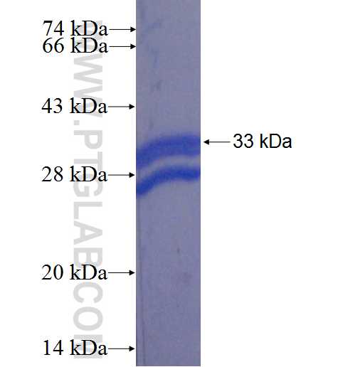 TMEM184A fusion protein Ag22657 SDS-PAGE