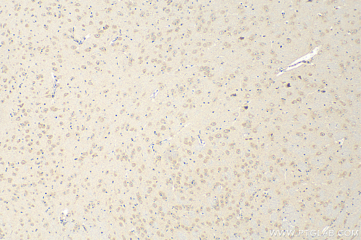 IHC staining of mouse brain using 28031-1-AP