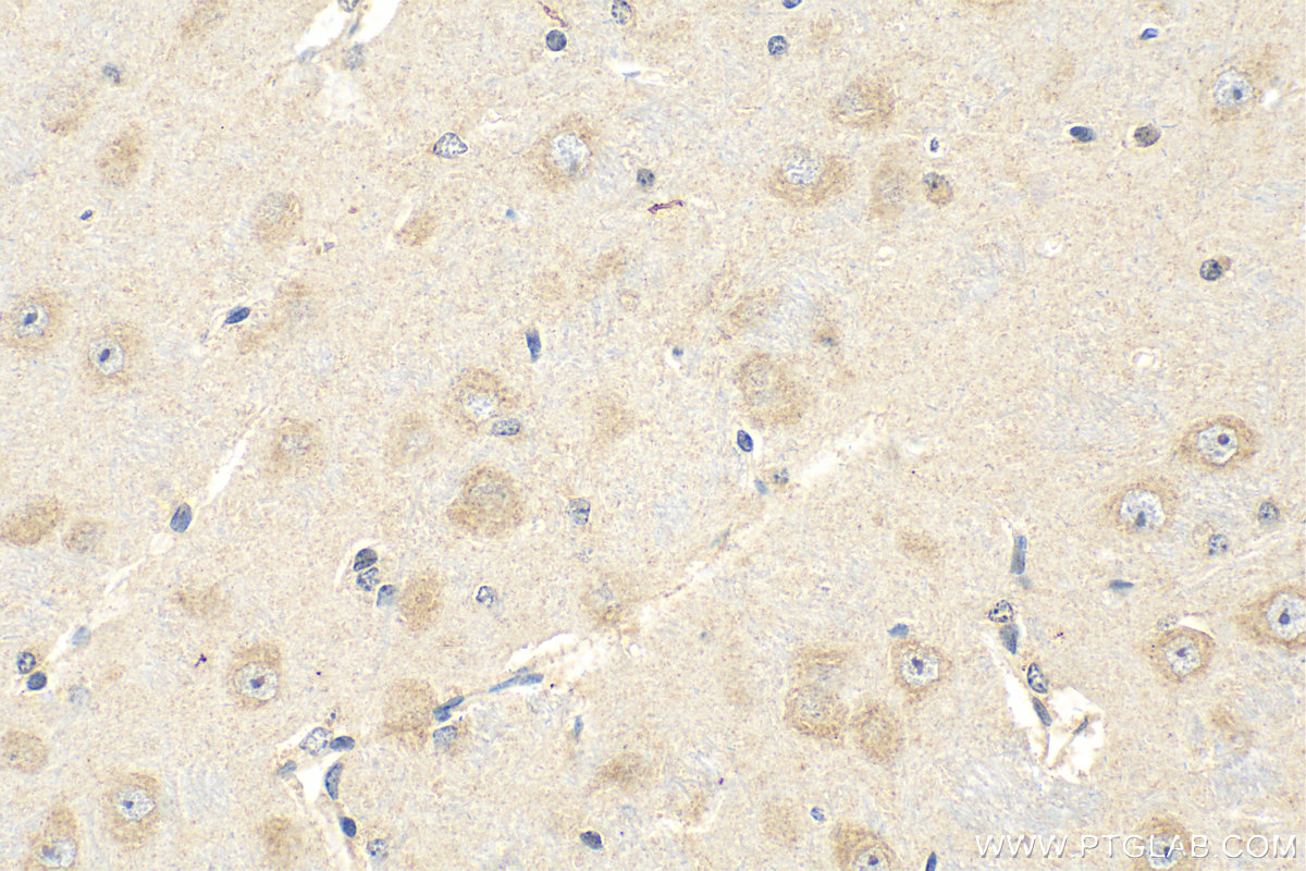 IHC staining of mouse brain using 28031-1-AP