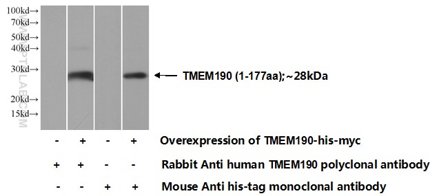 TMEM190