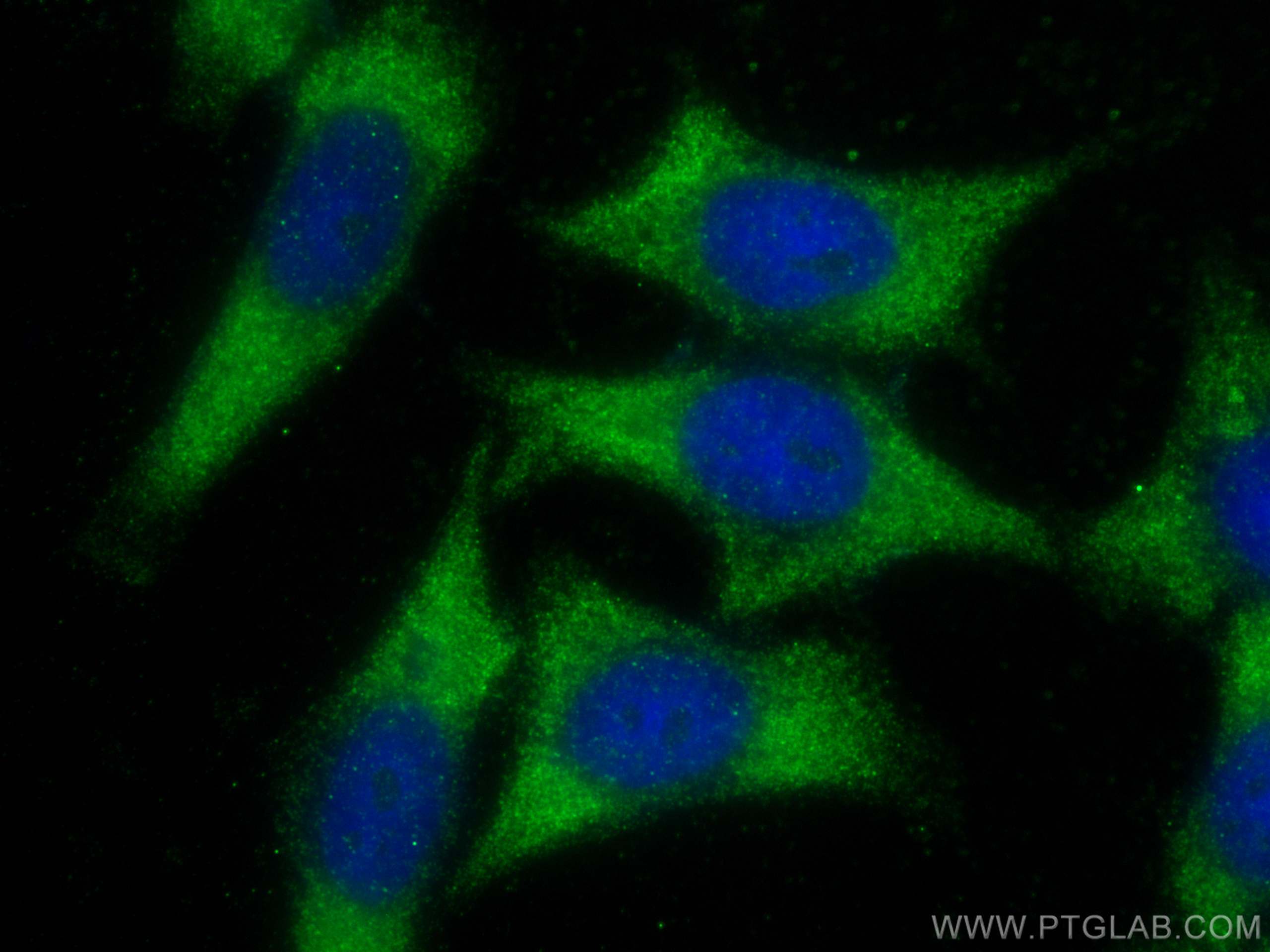 IF Staining of HepG2 using 25378-1-AP (same clone as 25378-1-PBS)