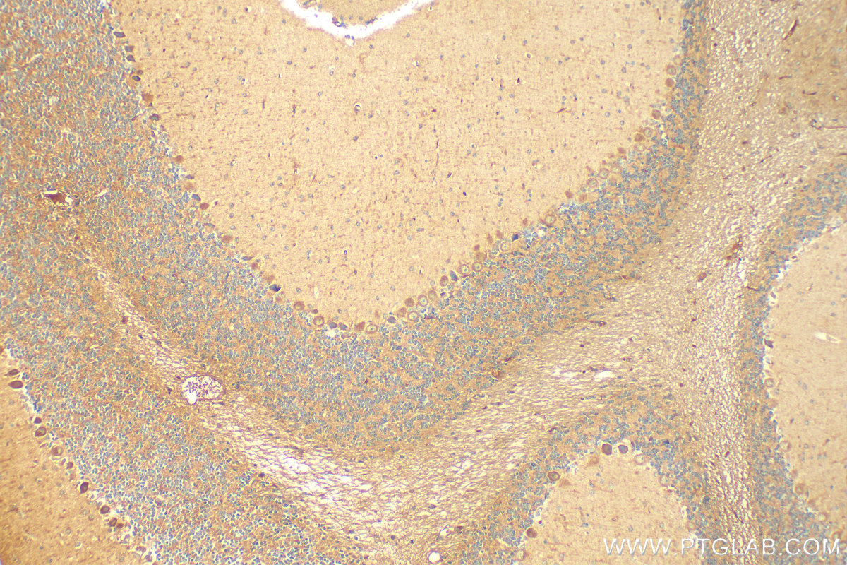 IHC staining of mouse cerebellum using 25378-1-AP (same clone as 25378-1-PBS)