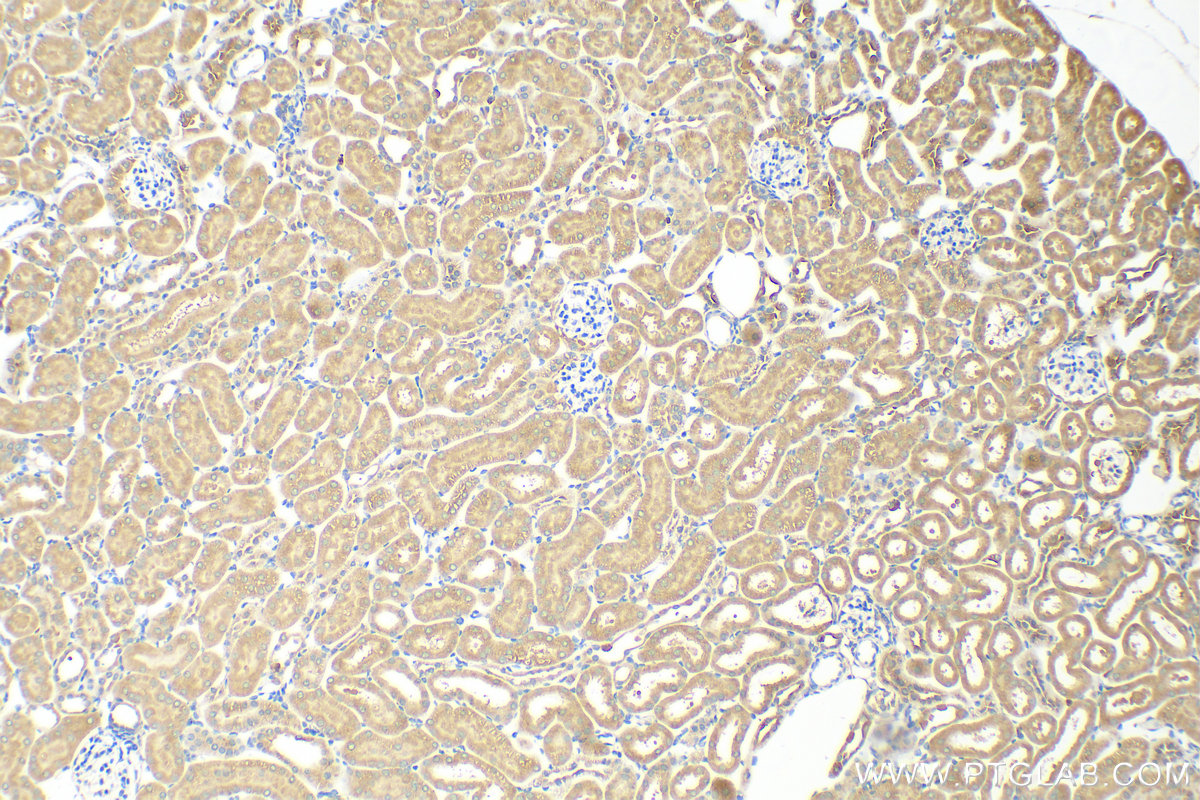 IHC staining of mouse kidney using 28596-1-AP