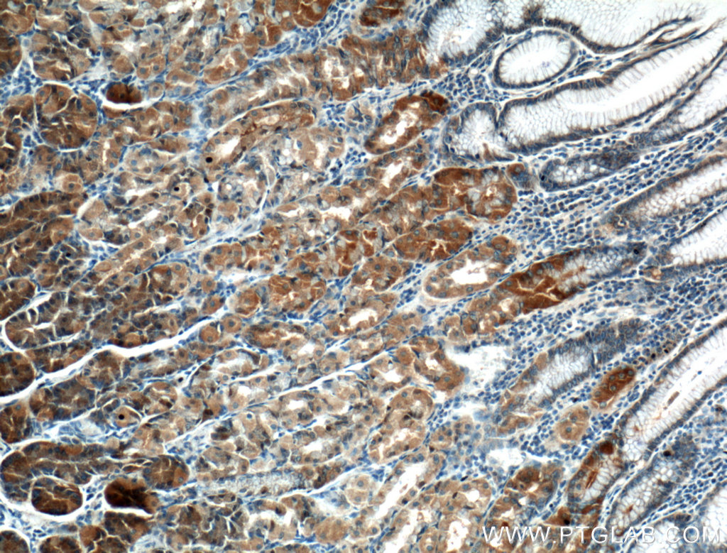 IHC staining of human stomach using 23882-1-AP