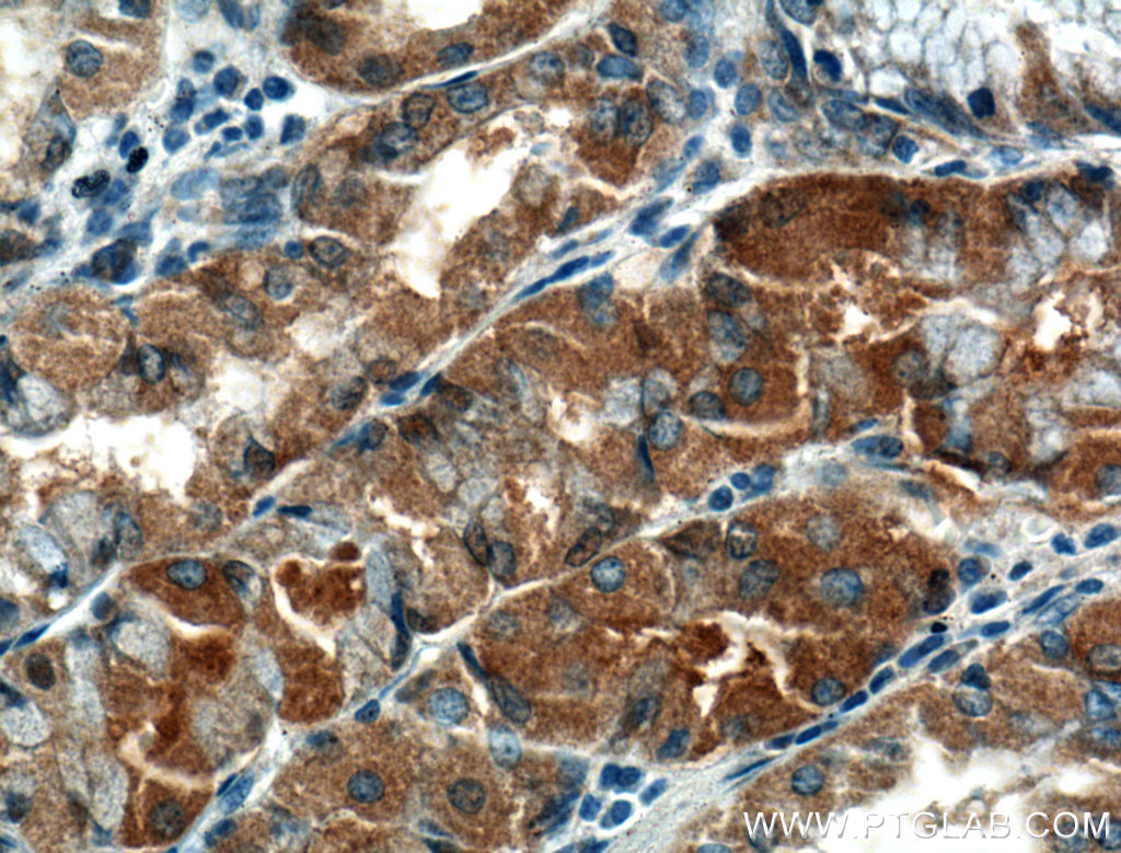 IHC staining of human stomach using 23882-1-AP