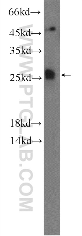 WB analysis of mouse brain using 23882-1-AP