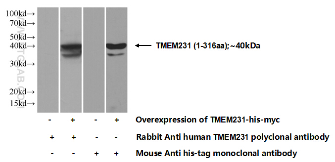 TMEM231