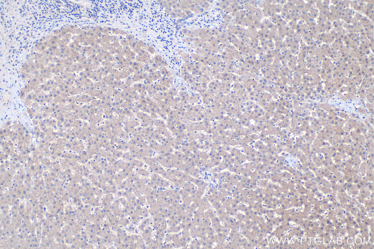 IHC staining of human liver using 24361-1-AP