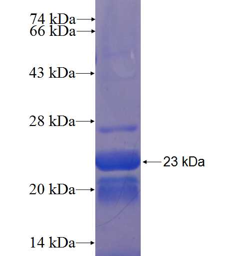 TMEM31 fusion protein Ag22376 SDS-PAGE