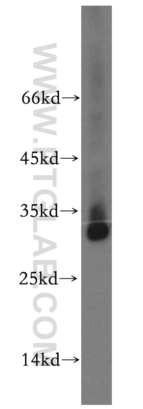 WB analysis of mouse skeletal muscle using 19920-1-AP