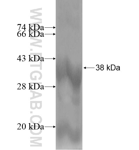 TMEM39A fusion protein Ag14263 SDS-PAGE