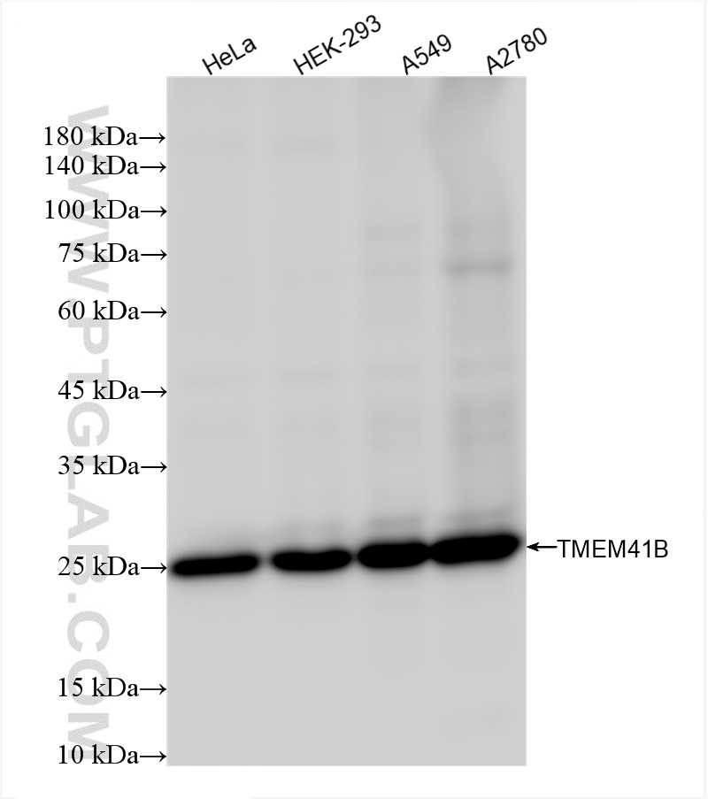 WB analysis using 84510-4-RR