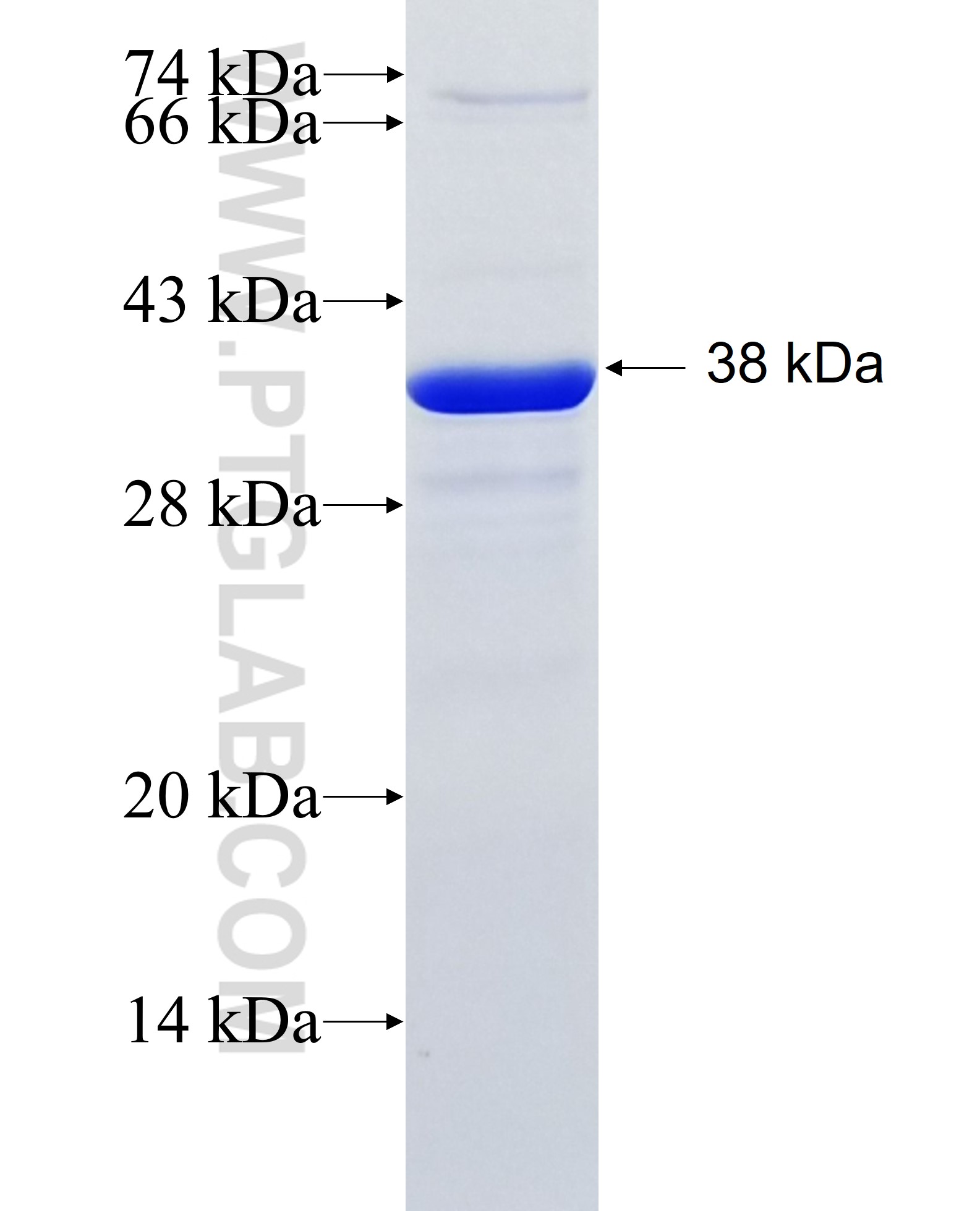 TMEM43 fusion protein Ag8522 SDS-PAGE