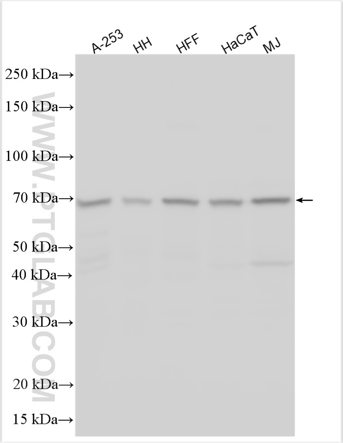 WB analysis using 27534-1-AP