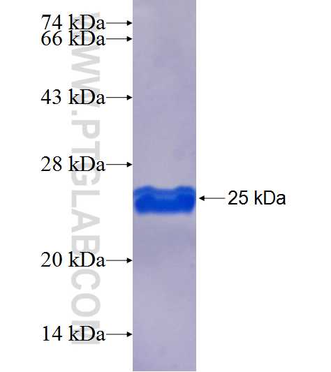 TMEM55B fusion protein Ag21180 SDS-PAGE