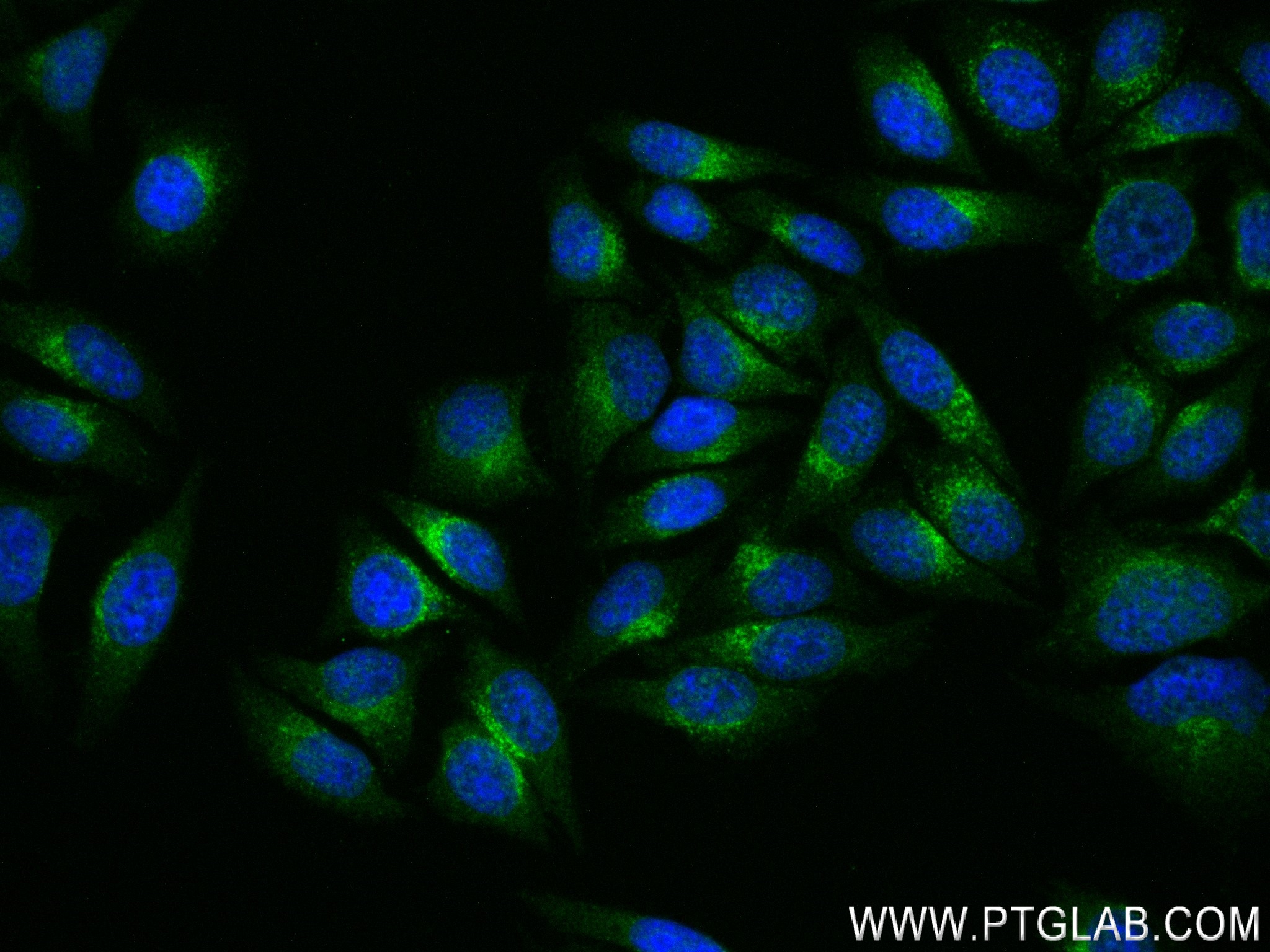 IF Staining of HepG2 using 83656-3-RR