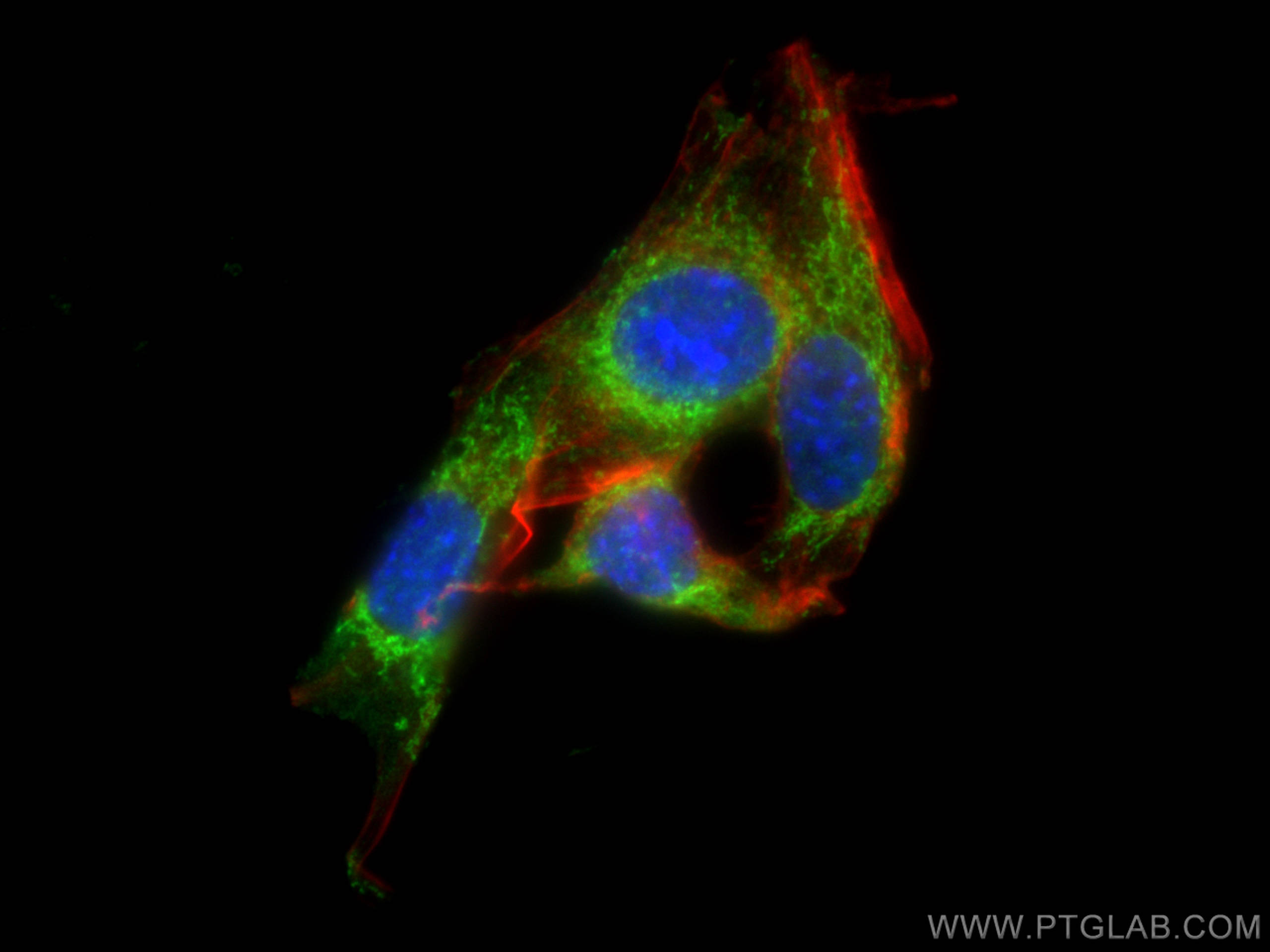 IF Staining of NIH/3T3 using 21913-1-AP (same clone as 21913-1-PBS)