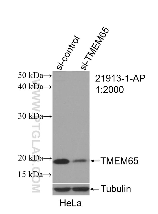 WB analysis of HeLa using 21913-1-AP